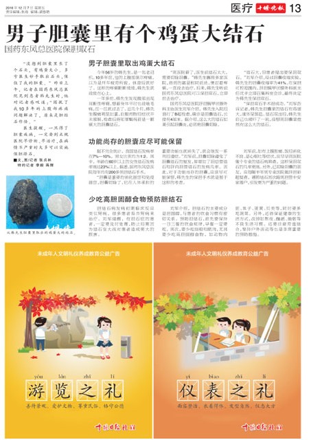 13版导读